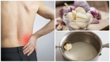 Sữa tỏi - phương thuốc tuyệt vời giúp giảm đau dây thần kinh hông